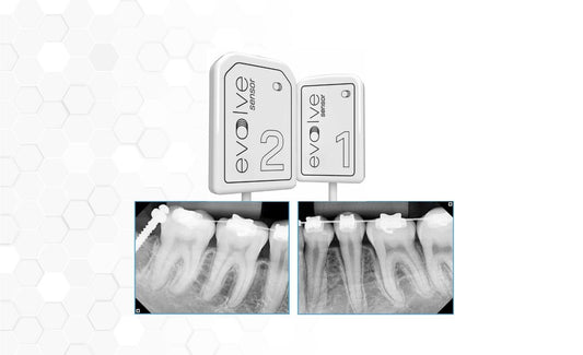 PREXION EVOLVE INTRAORAL SENSOR