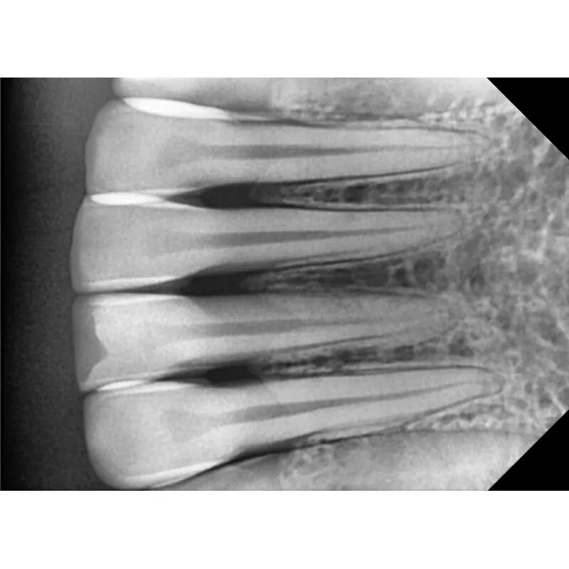 Drs Ray Digital X-Ray Sensors Available in Sizes 1.0, 1.5 & 2.0 By Good Drs