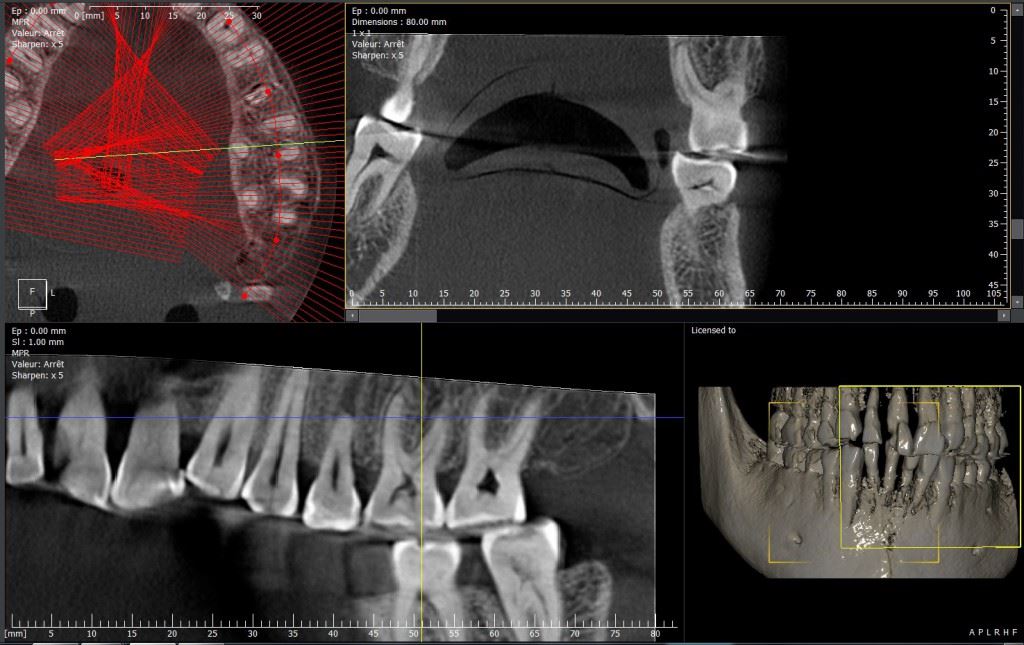 Endo View3 1024x645 1