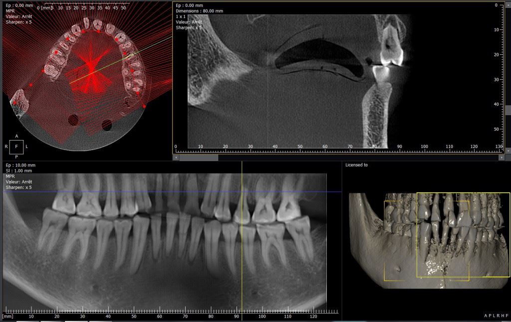 Endo View4 1024x646 1