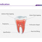 EndoCem Root Repair MTA Premix in a syringe