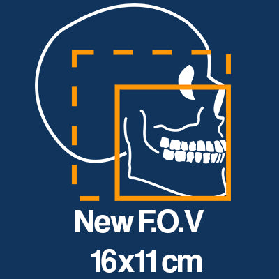 Owandy I-Max 3D XPRO EXTRAORAL X-RAY MACHINE