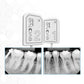 PREXION EVOLVE INTRAORAL SENSOR