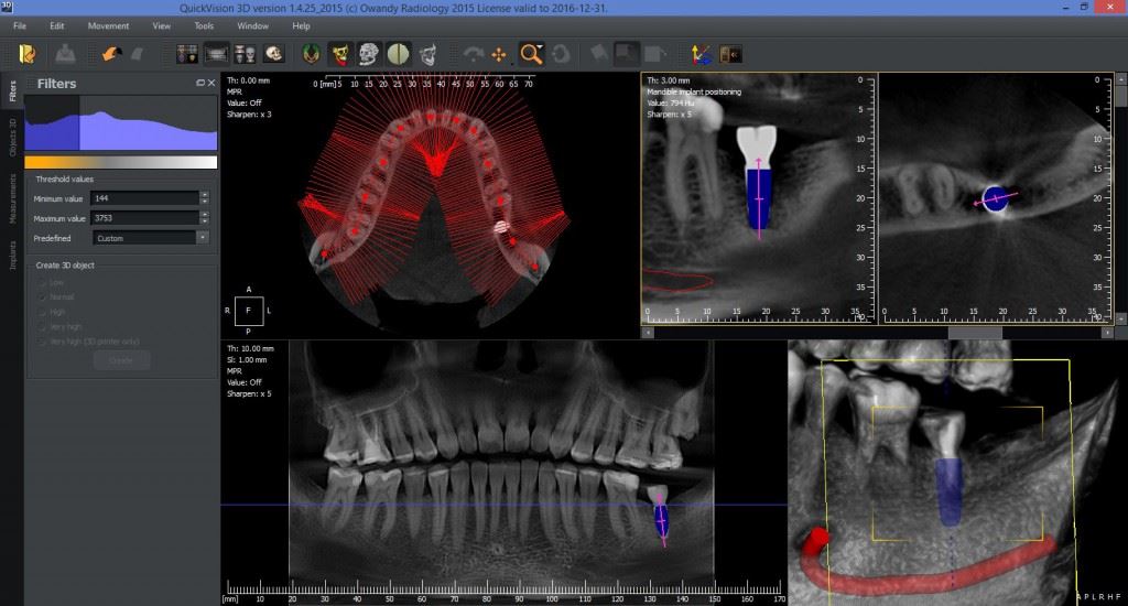 QuickVision3D screenshot01 1024x550 1