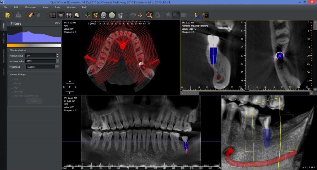 QuickVision3D screenshot02 1024x550 1