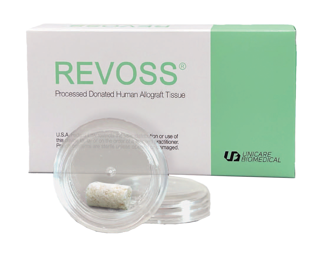 Revoss MATRIX, 100% Allograft, Bone Plus [11mm x 7.5mm]  5pcs/box
