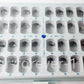 Redland DENTAL STAINLESS STEEL Permanent Molar Adult CROWN (KIT OF 48 PCS)