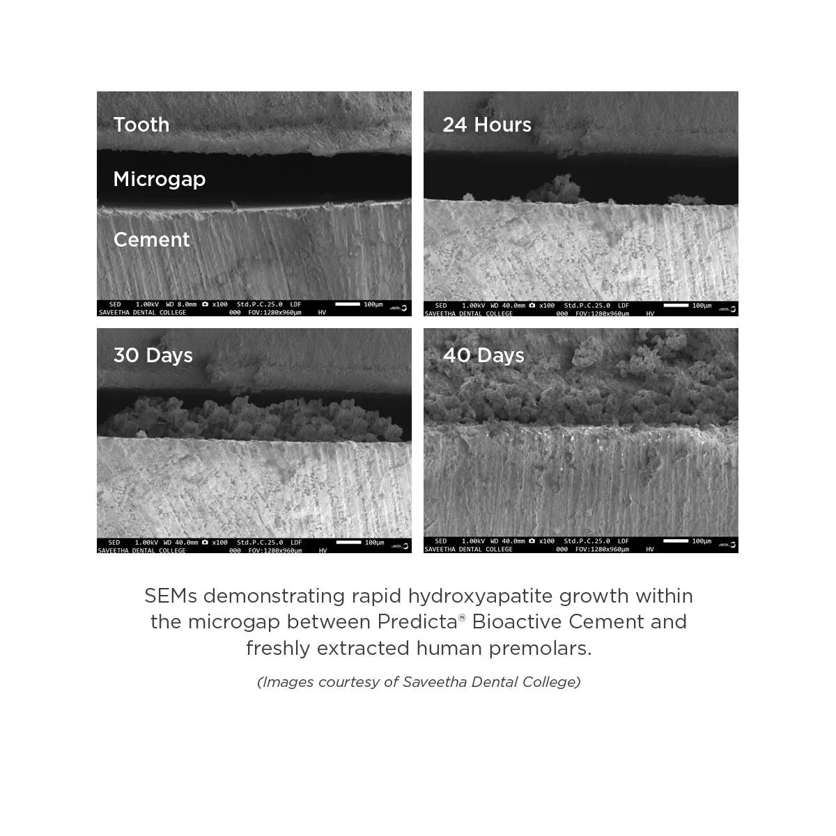 PARKELL PREDICTA BIOACTIVE CEMENT SELF ADHESIVE