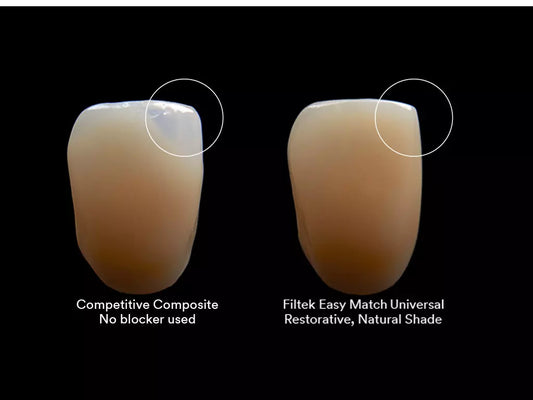 3M Filtek Easy Match Universal Restorative 0.2gm Capsules All Shades
