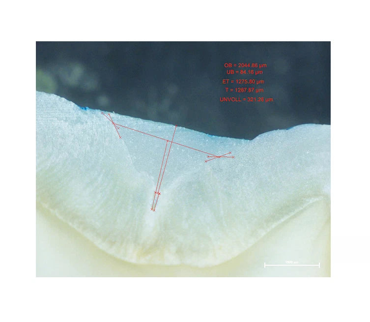 Premier® BioCoat new bioactive resin pit and fissure sealant 1.2mL Syringe