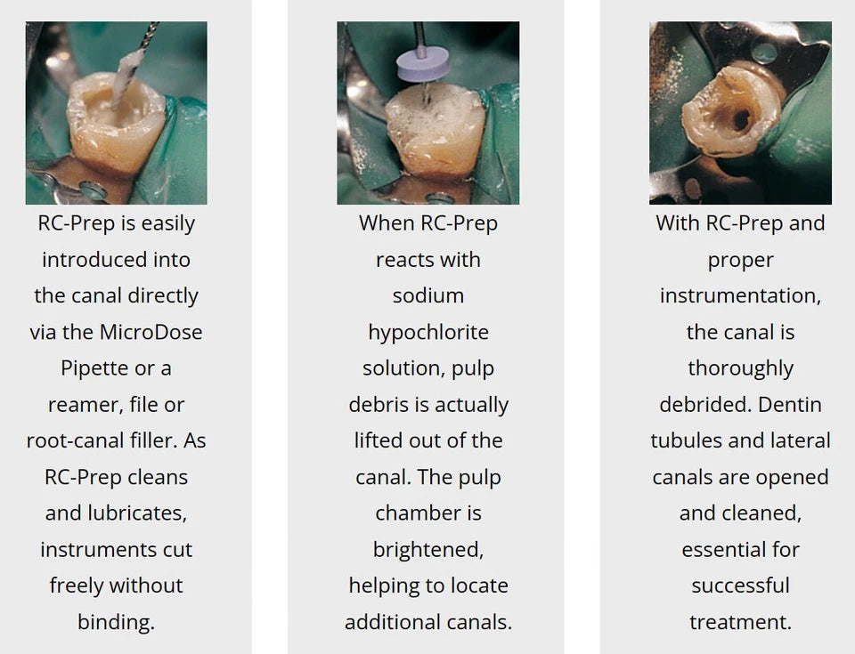 Premier DENTAL RC-Prep Chemo-Mechanical Preparation of Root Canals, 9GM SYRINGES