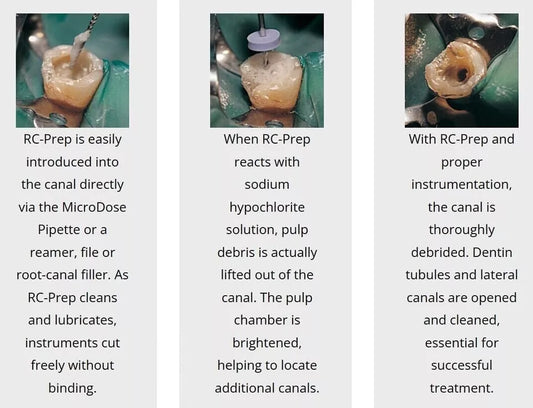 Premier DENTAL RC-Prep Root Canal Chemo-Mechanical Preparation Cream 1x 227gm